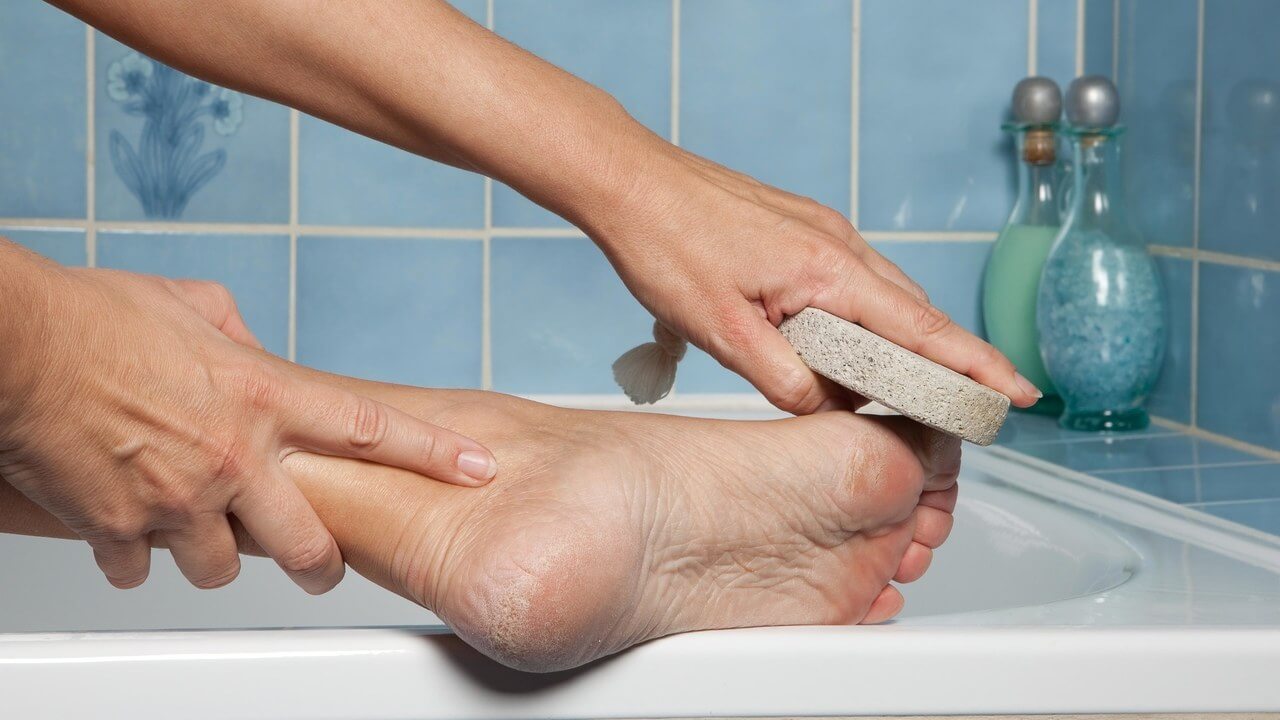 Cách ngâm chân chữa nứt gót chân